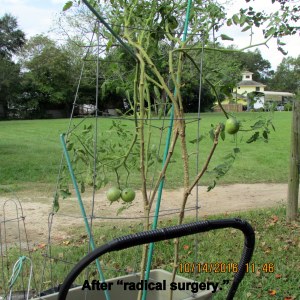 After radical surgery